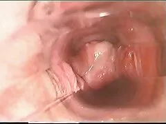 Alektra کی ڈک معائنہ